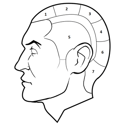 Micro Hair Pigmentation zones