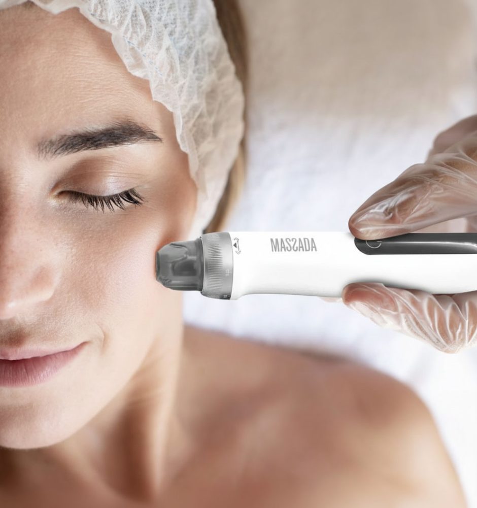 Microneedling behandeling gezicht