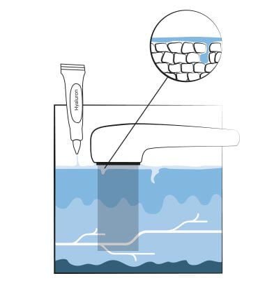 MicroSkinPolish-LowLevelLaser